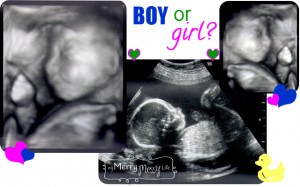 sonogram