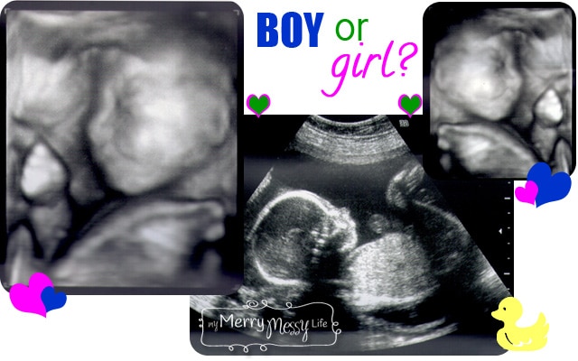 Our Pregnancy Adventure – The Sonogram