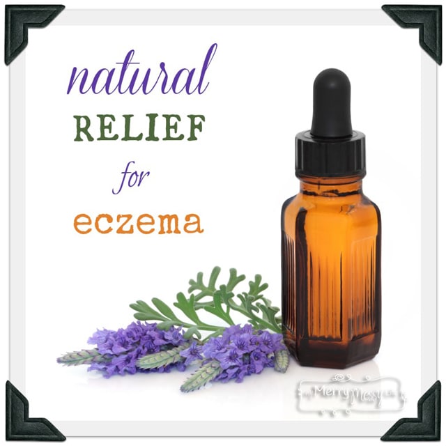 Natural Relief for Eczema and Dry Skin via My Merry Messy LIfe