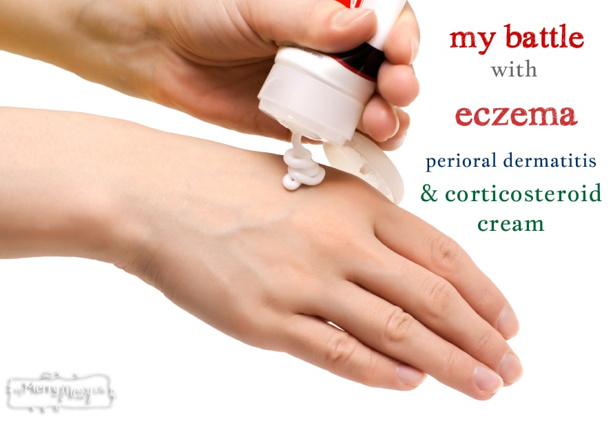 My Battle with Eczema, Perioral Dermatitis, and Corticosteroid Cream