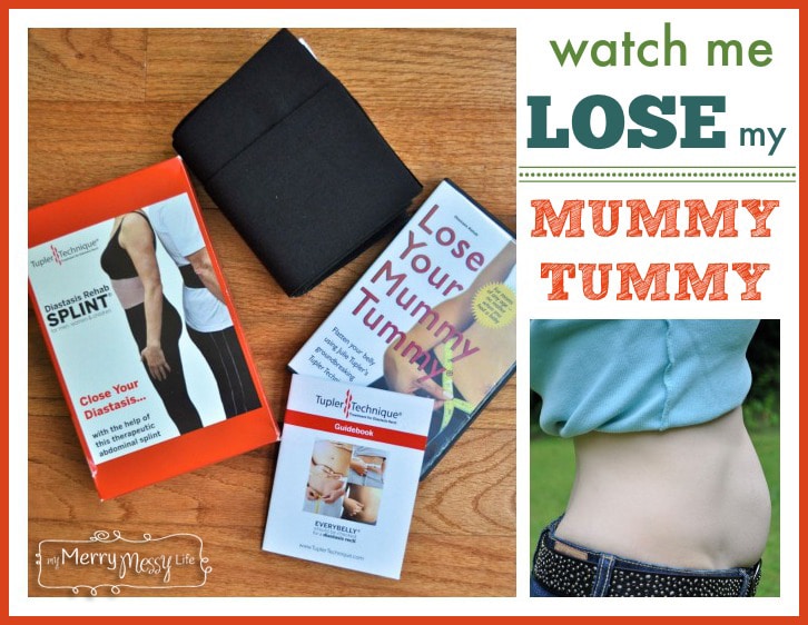 Watch Me Lose My "Mummy Tummy" - The Tuppler Technique to Close a Diastasis Recti