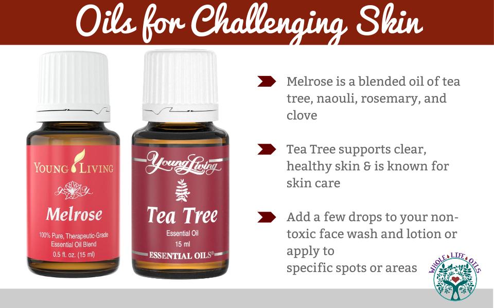 Essential Oils for Challenging Skin