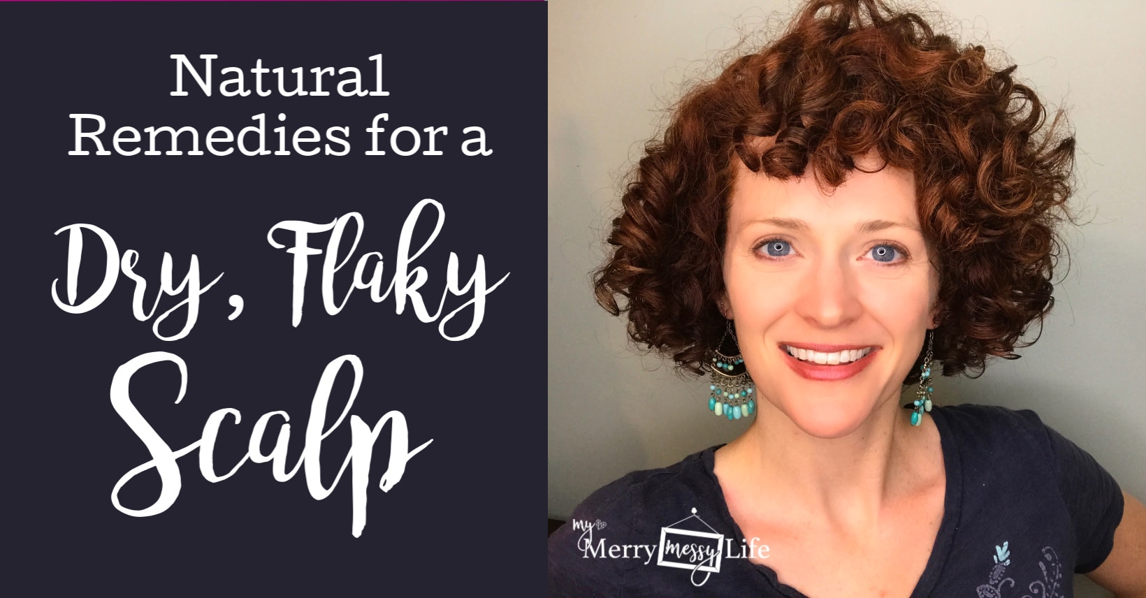 Natural Remedies for a Dry, Itchy, Flaky Scalp using essential oils, natural shampoos, a sugar scrub, clean diet and supplements