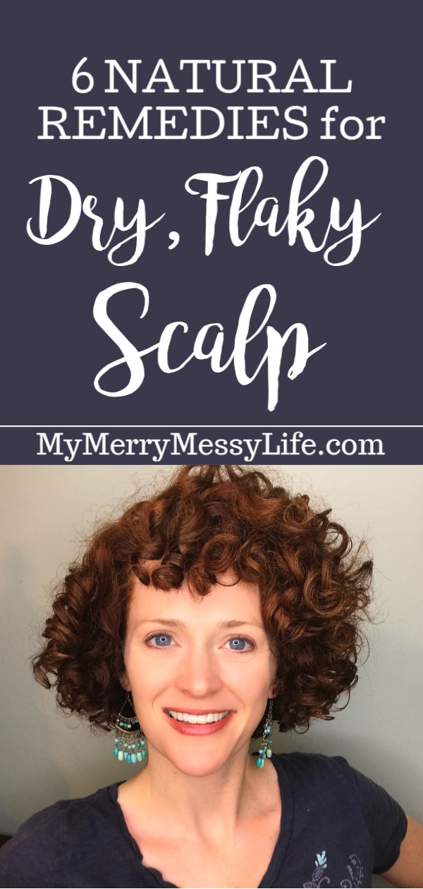 6 Natural Remedies for a Dry, Itchy, Flaky Scalp including essential oils, scalp massages, natural hair products, natural hair color and more!